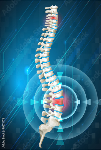 Human spine showing back pain