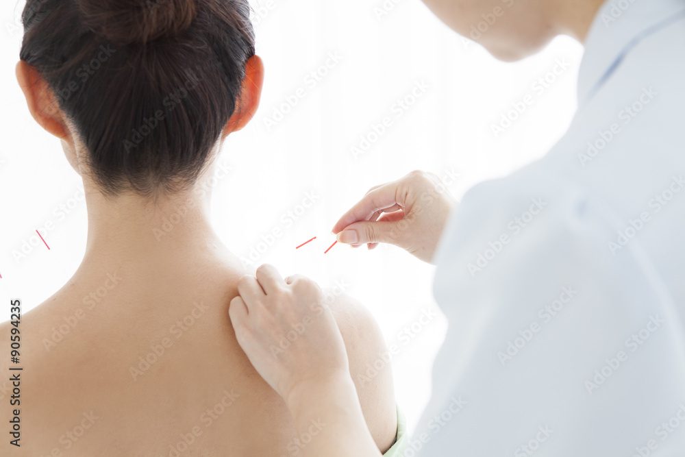 Acupuncturists are pierced acupuncture to women's shoulder
