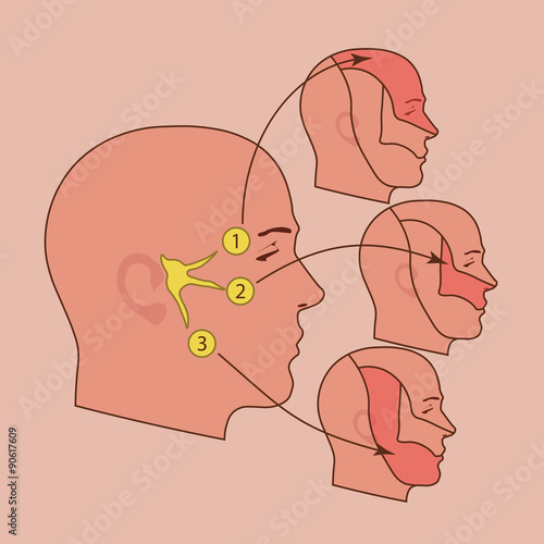 The trigeminal nerve
