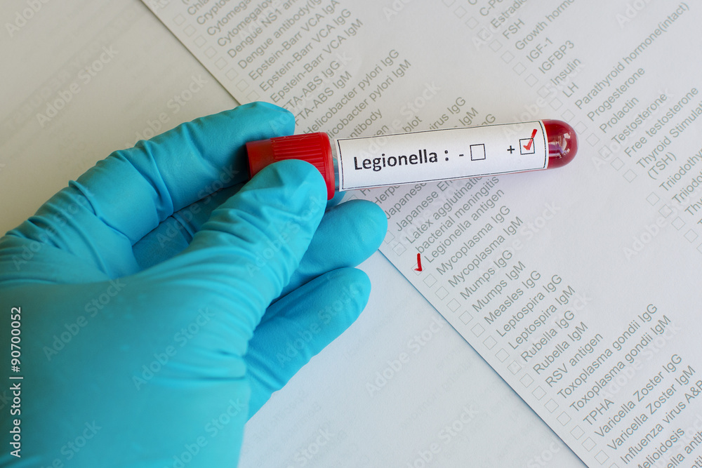 Foto Legionella positive