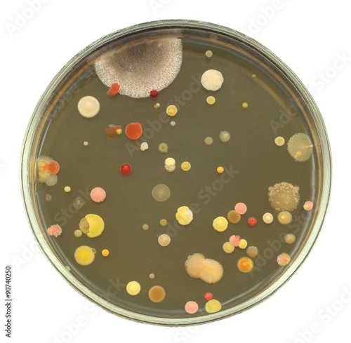 Different color, size and type colonies of bacteria from public hall air on a petri dish (agar plate) isolated on black background. 