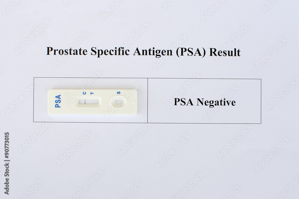 PSA testing by using test cassette, the result showed negative (single red line) PSA testing by using test cassette, the result showed negative (single red line)