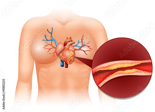 Heart Cholesteral in human