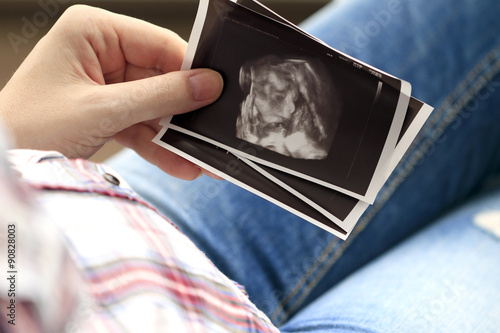 ultrasound 3D, pregnancy, women, hans photo