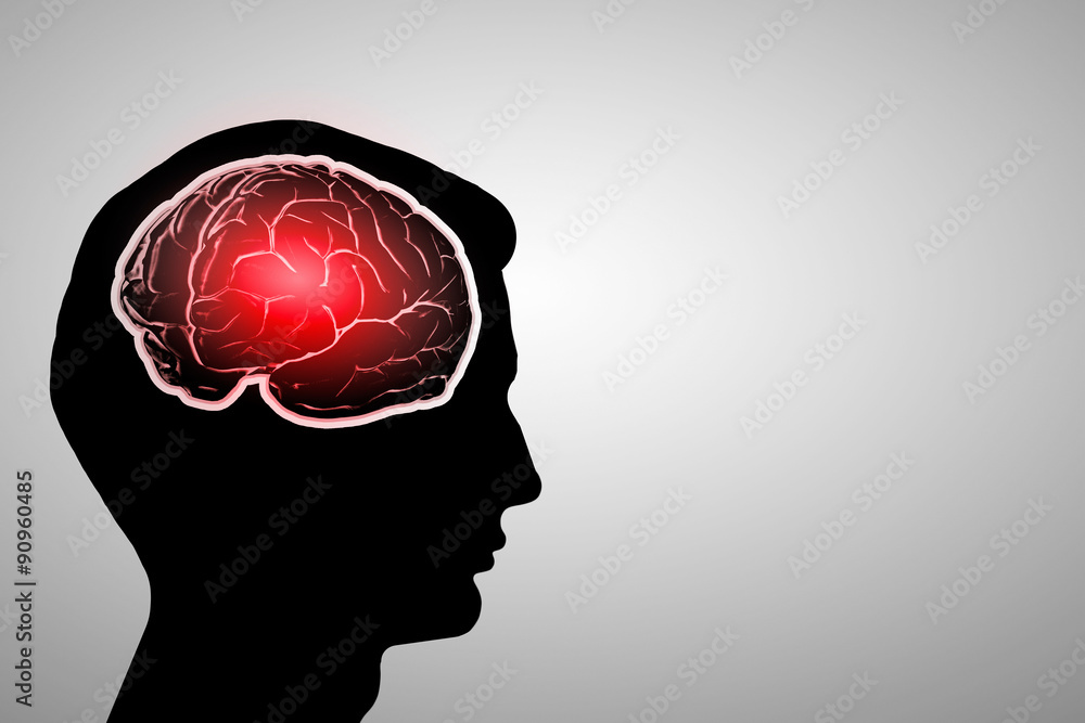 Mental health Mental health