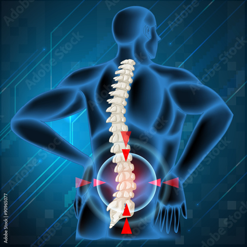 Spine bone showing back pain