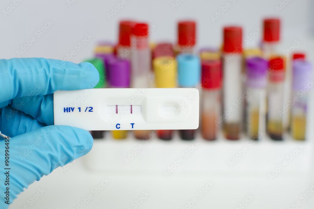 HIV positive result HIV positive result