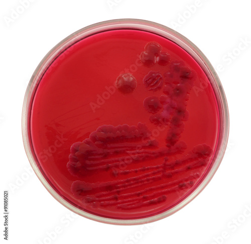 An Escherichia coli bacterium grows on agar Endo. Big colonies in color of nutrient media stain. Isolation on the white background. Sharp isolation by pen tool.