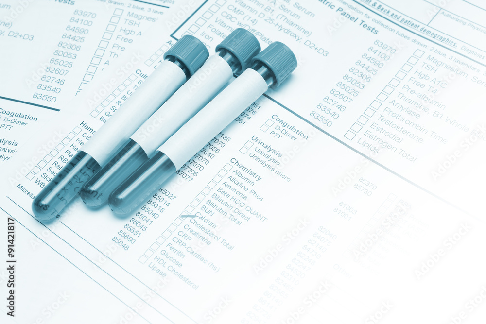 Form to fill in the results of biochemistry blood tests Form to fill in the results of biochemistry blood tests