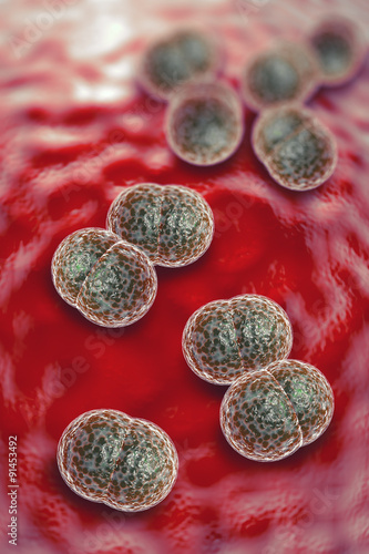 Meningitis Bacteria Infection