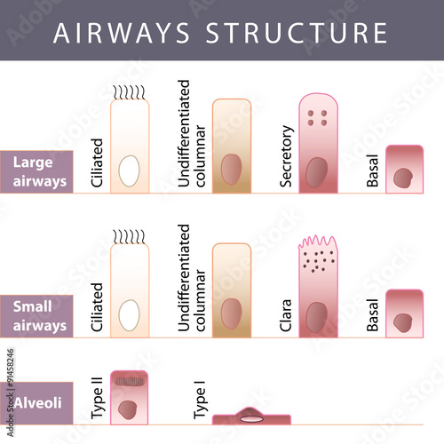 Airways structure