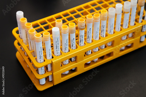 Test Tubes with Samples in Yellow Rack