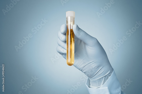 Doctor's hand with urine sample photo