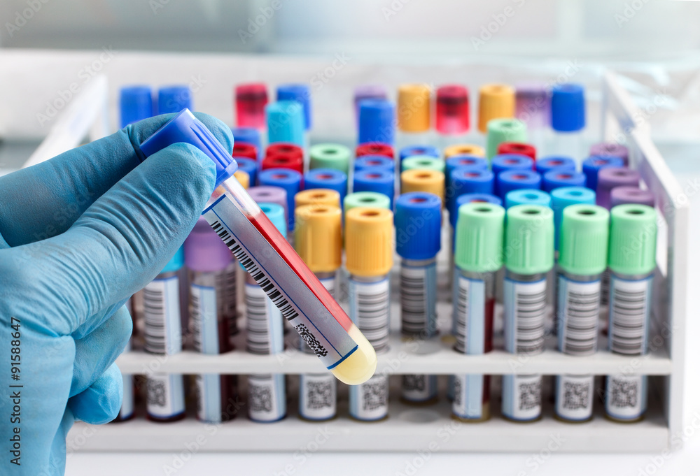 laboratory technician holding a blood tube test labeled with bar / hand