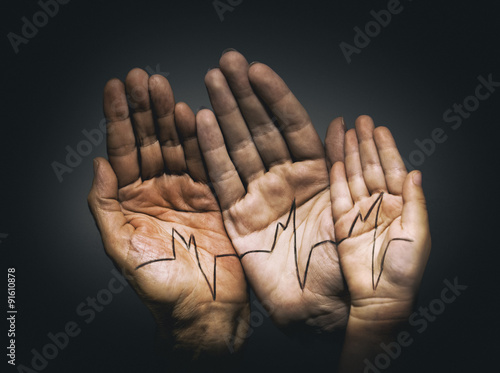 Εκτύπωση καμβά palm