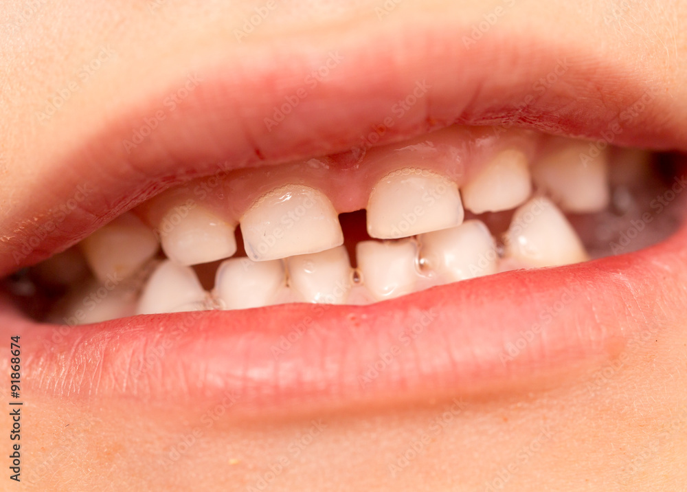 Naklejka premium baby teeth in the mouth