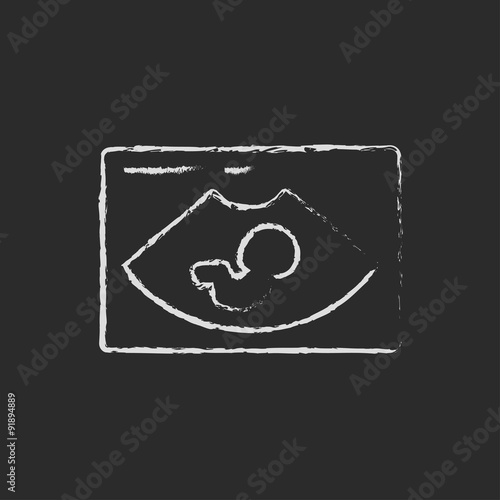 Fetal ultrasound icon drawn in chalk.