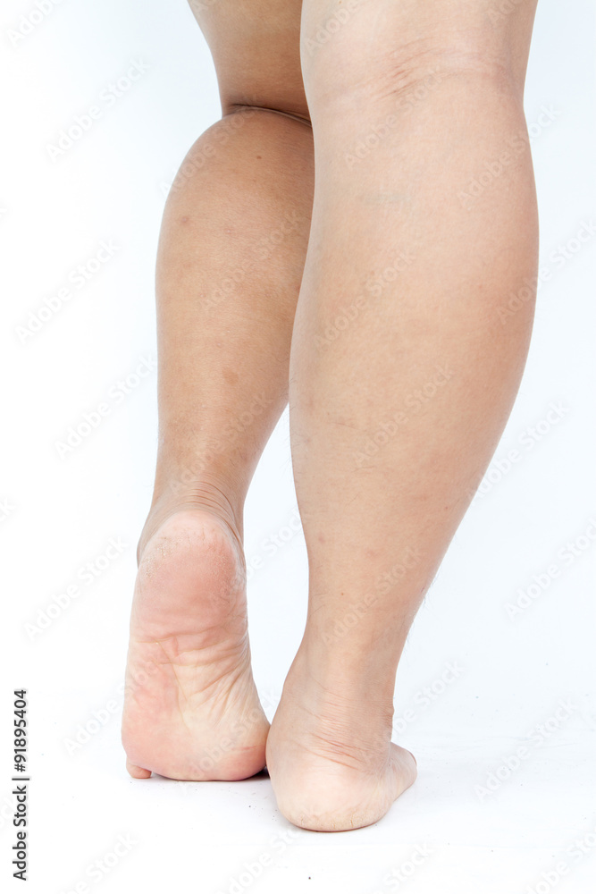 Asian fat women's legs. Stock Photo | Adobe Stock