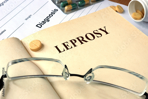 Photo Word  Leprosy on a paper and pills on the wooden table.