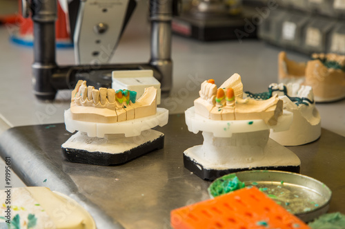 Fotografie materials for dental prostheses