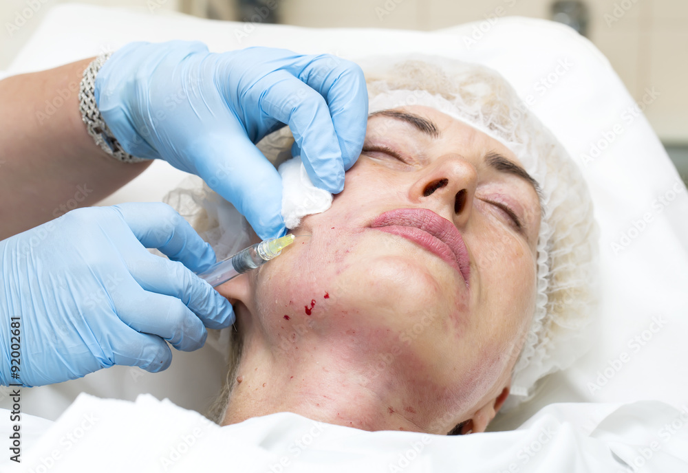 Cosmetic treatment with injection in a clinic Cosmetic treatment with injection in a clinic