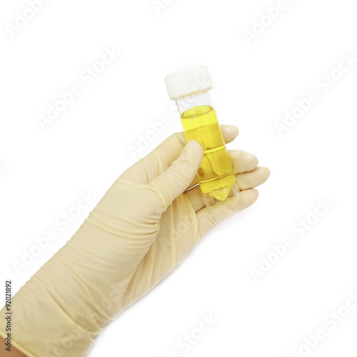 container for uridoctor's hand in white gloves holding a transpa photo