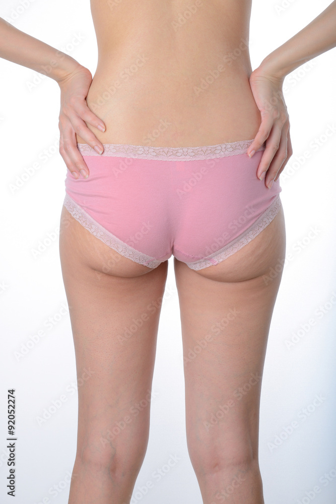asian woman show her fat and cellulite on buttocks asian woman show her fat and cellulite on buttocks