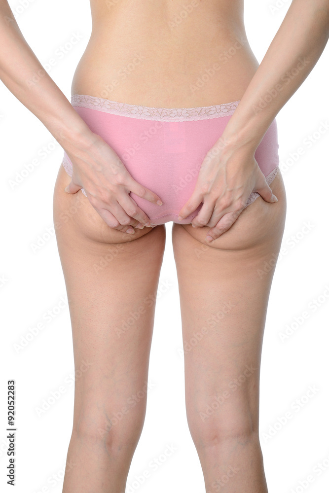 asian woman show her fat and cellulite on buttocks asian woman show her fat and cellulite on buttocks