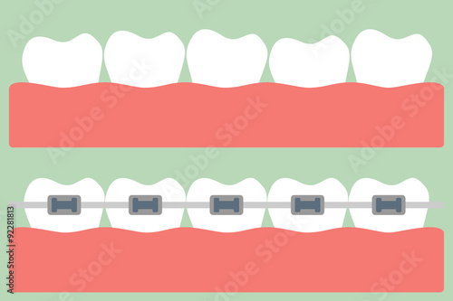 teeth orthodontics