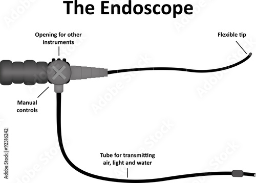 The Endoscope Labeled Diagram