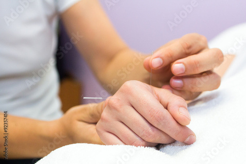 Wallpaper Mural agujas de acupuntura en mano Torontodigital.ca