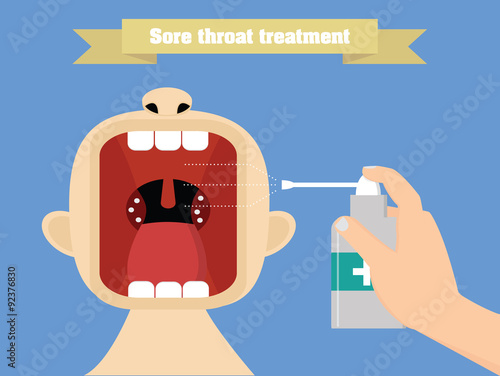 Sore throat treatment with aerosol. Quinsy treatment conceptual illustration