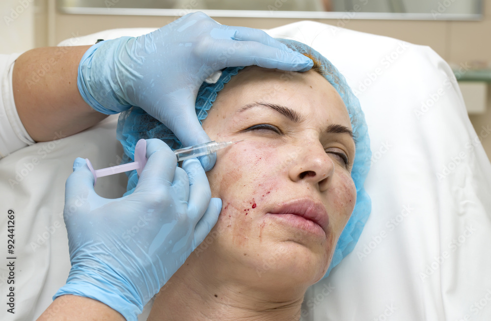 Cosmetic treatment with injection in a clinic Cosmetic treatment with injection in a clinic