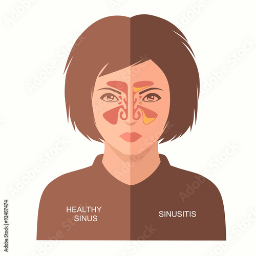 sinusitis disease, vector nose illustration, sinus anatomy, human respiratory system
