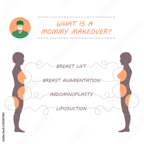 vector woman body, plastic surgery, mommy makeover, liposuction, breast augmentation