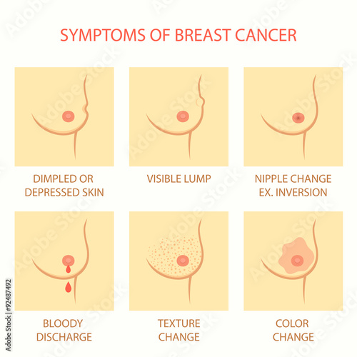 skin symptoms of breast cancer, self examination, tumor body exam