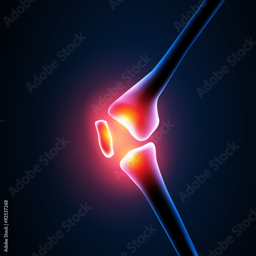 Painful Knee Close-up easy editable