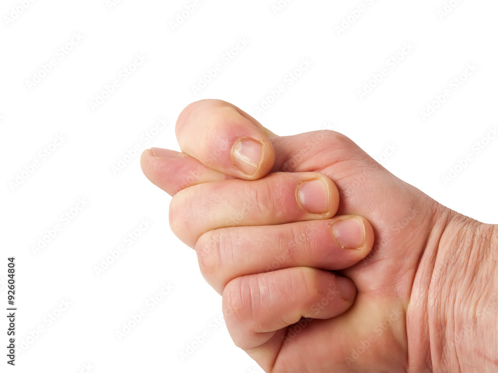 Fig gesture Fig gesture