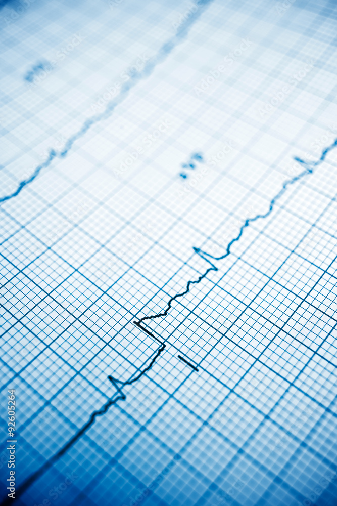 Naklejka premium Electrocardiogram