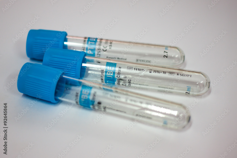 Close up test tubes for testing Close up test tubes for testing