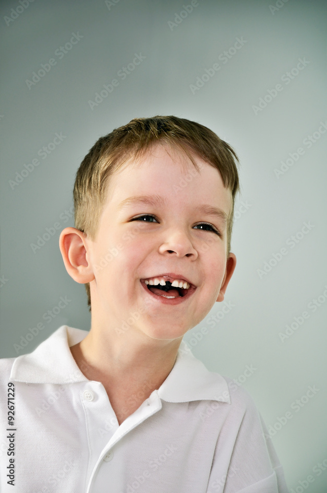 laughing boy portrait. the boy opened his mouth and lost a tooth laughing boy portrait. the boy opened his mouth and lost a tooth