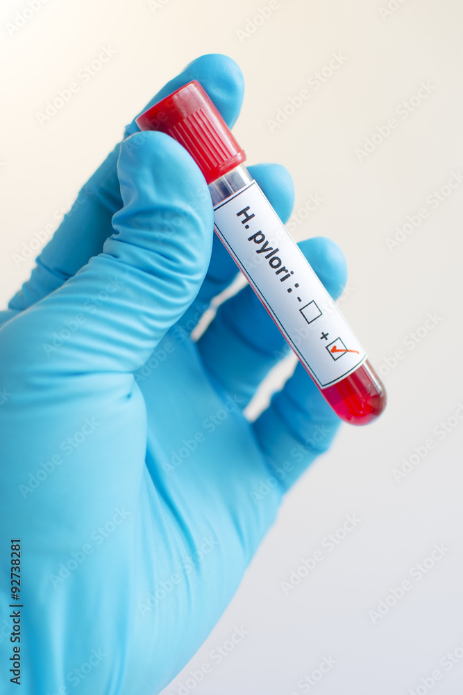 Naklejka premium H. pylori blood sample