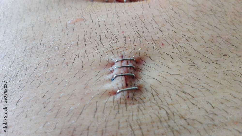 Obraz premium Chirurgie hdr