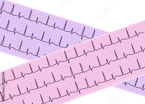Wallpaper Mural Heart analysis, electrocardiogram graph (ECG) Torontodigital.ca