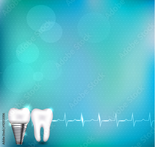 Dental implant and normal tooth