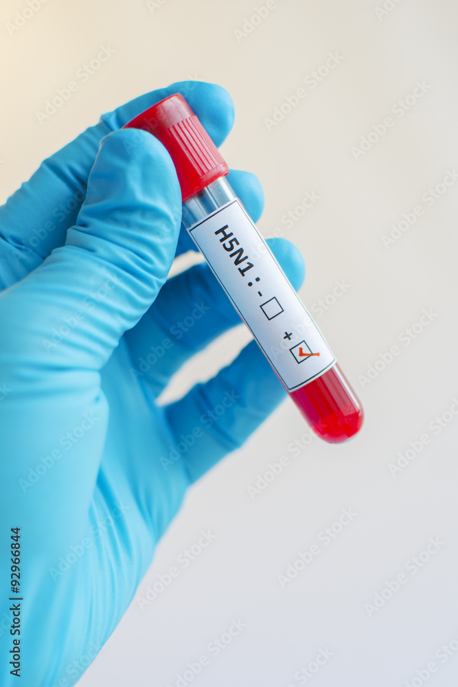 Fototapeta premium H5N1 influenza virus positive