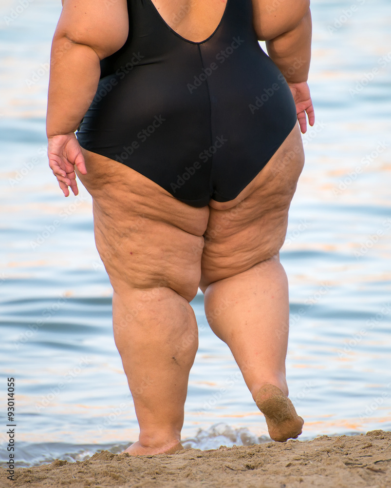 Overweight woman on the beach. Unrecognizable person. Stock Photo | Adobe  Stock