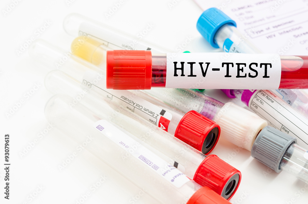 Sample blood collection tube with HIV test. Sample blood collection tube with HIV test.