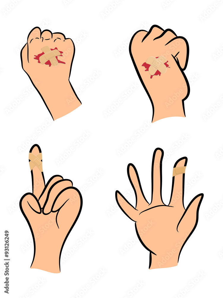 Set of Injured finger, hand wrapped in adhesive bandage, plaster with red  blood puddle. Vector illustration isolated on white background. Stock  Vector
