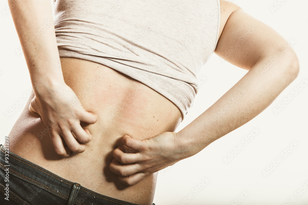 custom made wallpaper toronto digitalHuman scratching itchy back skin. Rash.